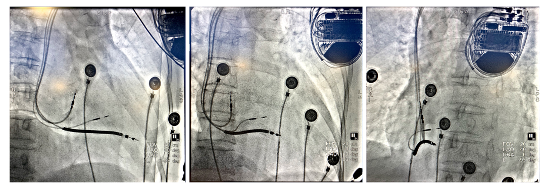 1574740042598040276.png WPS图片-拼图5.png