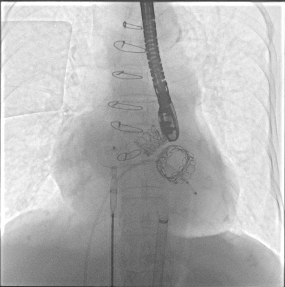 1672101592846032043.png 微信图片_20221226165154.png