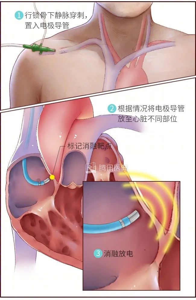 1690947427881112.jpg 3.jpg