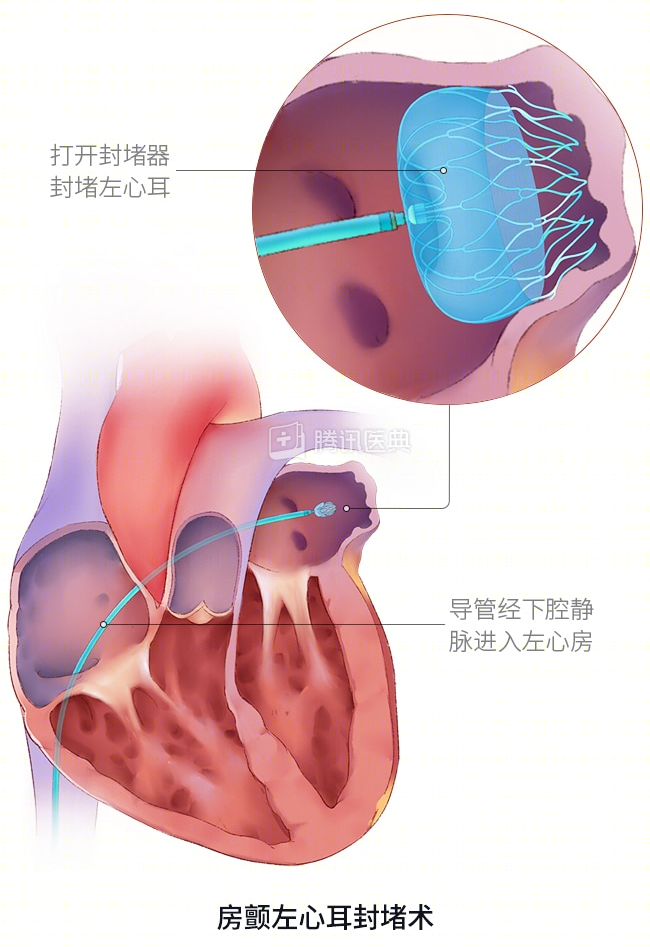 1690947455236229.png 5.png